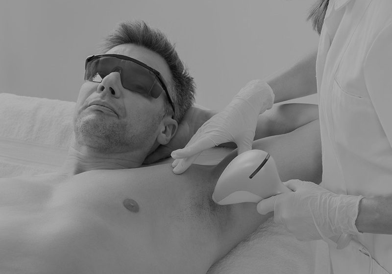 Laser Hair Removal