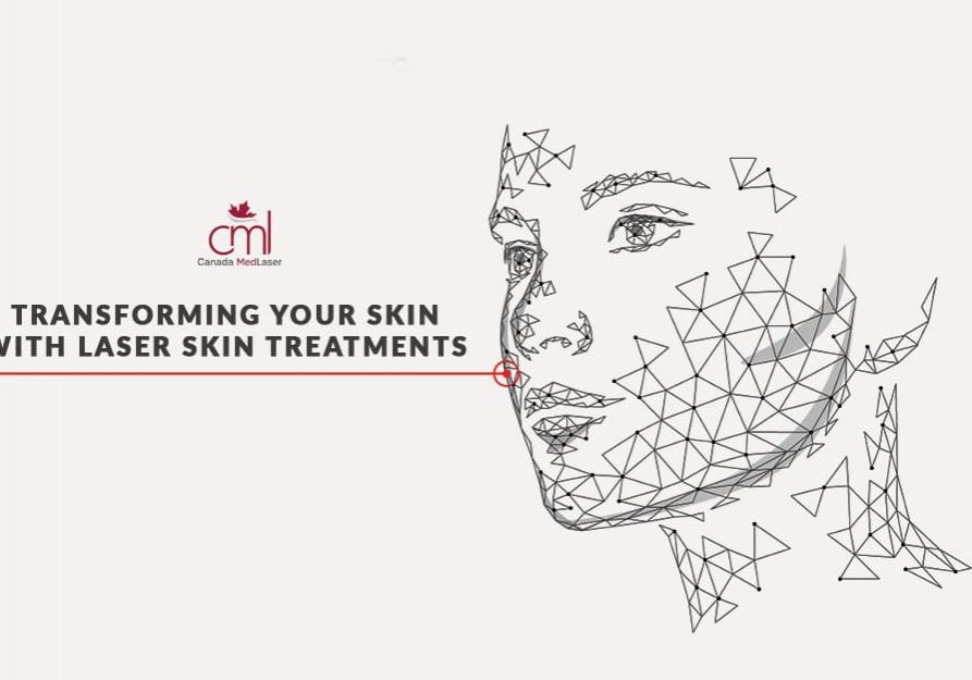 Laser Skin Resurfacing