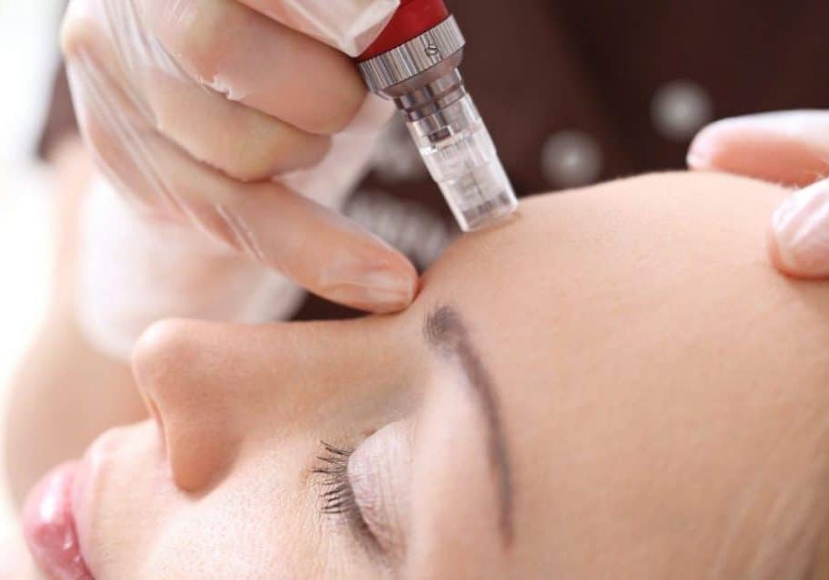 Microneedling vs. At Home Dermaroller