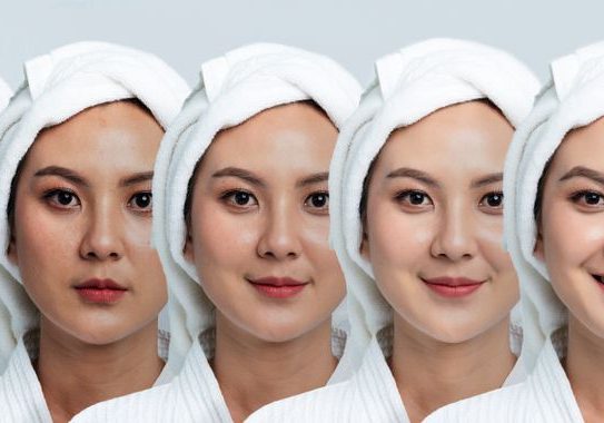 What is Skin Pigmentation