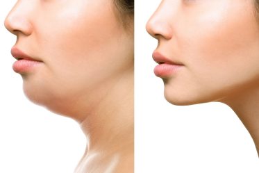 Part of face, woman with the double and perfect chin isolated on white background Beauty concept.