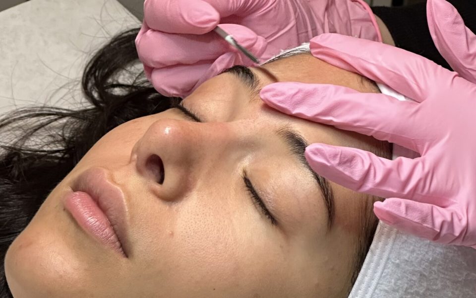 Facial Treatment - Canada MedLaser