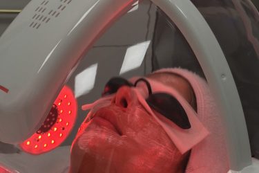 Facial Treatment - Canada MedLaser