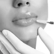 Lip Filler Black and White - Canada MedLaser