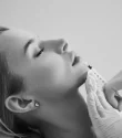 Lip Fillers - Whitby Clinic
